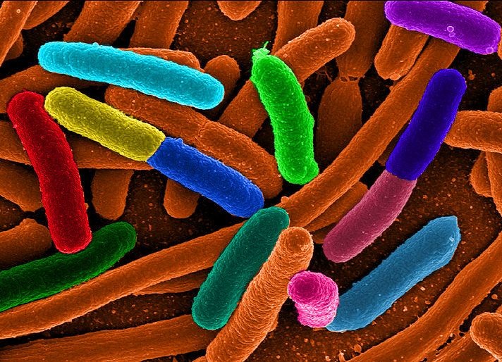 diverse e coli