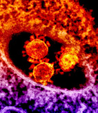 images 1coronaviruslt